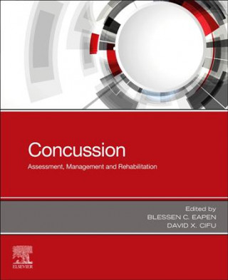 Concussion