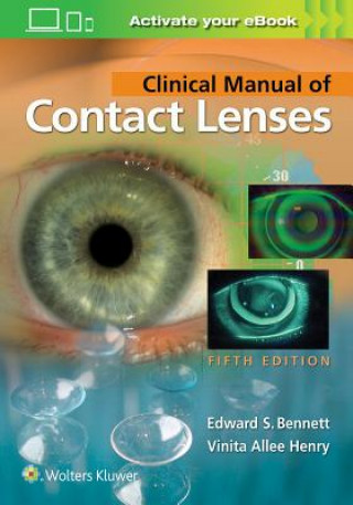 Clinical Manual of Contact Lenses (Edward S. Bennett,Vinita Allee Henry)()