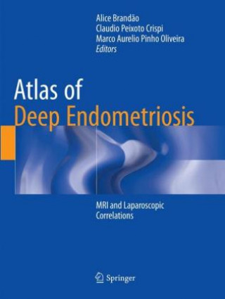 Atlas of Deep Endometriosis (Alice Brandão,Claudio Peixoto Crispi,Marco Aurelio Pinho Oliveira)(Brožovaná)