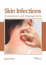 Skin Infections: Assessment and Management