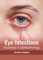 Eye Infections: Essentials in Ophthalmology