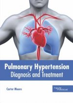 Pulmonary Hypertension: Diagnosis and Treatment
