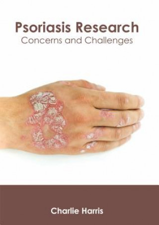 Psoriasis Research: Concerns and Challenges