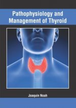 Pathophysiology and Management of Thyroid