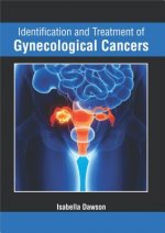 Identification and Treatment of Gynecological Cancers