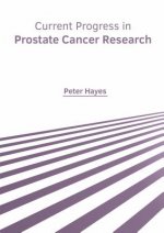 Current Progress in Prostate Cancer Research