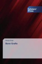 Bone Grafts