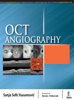 OCT Angiography