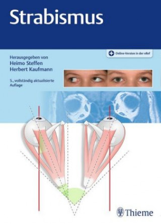 Strabismus