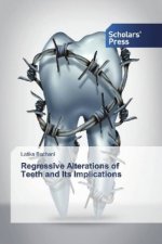 Regressive Alterations of Teeth and Its Implications