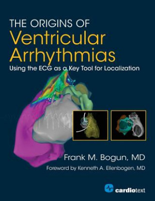 Origins of Ventricular Arrhythmias