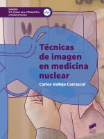 TÈCNICAS DE IMAGEN EN MEDICINA NUCLEAR. GRADO SUPERIOR