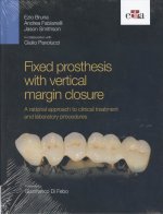FIXED PROSTHESIS WITH VERTICAL MARGIN CL