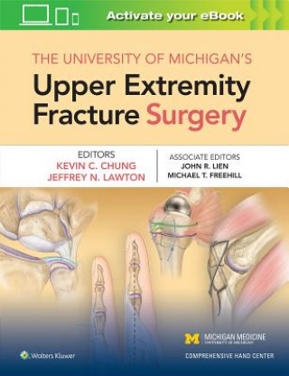 University of Michigan's Upper Extremity Fracture Surgery