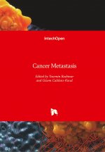 Cancer Metastasis