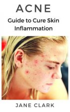 Acne: Guide to Cure Skin Inflammation