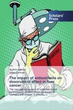 The impact of antioxidants on doxorubicin effect in liver cancer