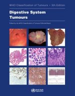 Digestive System Tumours: Who Classification of Tumours