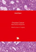 Ovarian Cancer