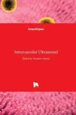 Intravascular Ultrasound