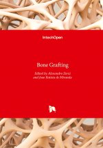 Bone Grafting