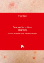 Acne and Acneiform Eruptions