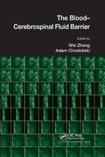 Blood-Cerebrospinal Fluid Barrier