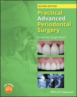 Practical Advanced Periodontal Surgery, 2nd 2nd Edition