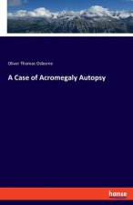 Case of Acromegaly Autopsy