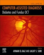 Diabetes and Fundus OCT