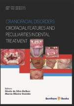 Craniofacial disorders - orofacial features and peculiarities in dental treatment
