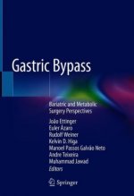 Gastric Bypass