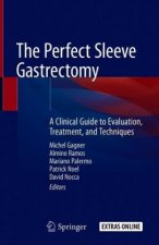The Perfect Sleeve Gastrectomy