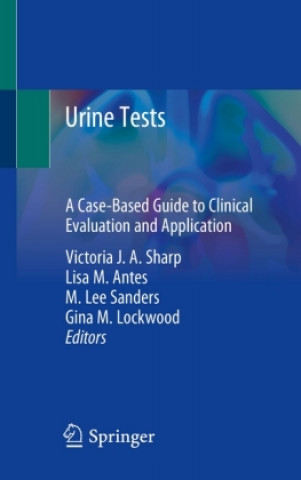 Urine Tests