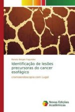 Identificacao de lesoes precursoras do cancer esofagico