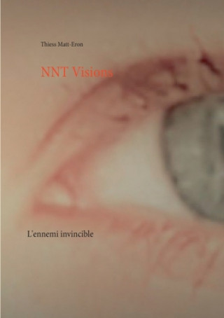 NNT Visions