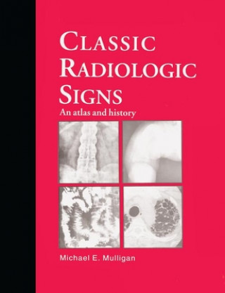 Classic Radiologic Signs