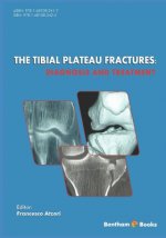 The Tibial Plateau Fractures: : Diagnosis and Treatmment