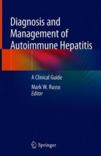 Diagnosis and Management of Autoimmune Hepatitis