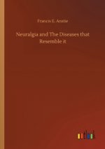 Neuralgia and The Diseases that Resemble it