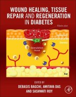 Wound Healing, Tissue Repair, and Regeneration in Diabetes