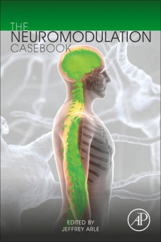 Neuromodulation Casebook