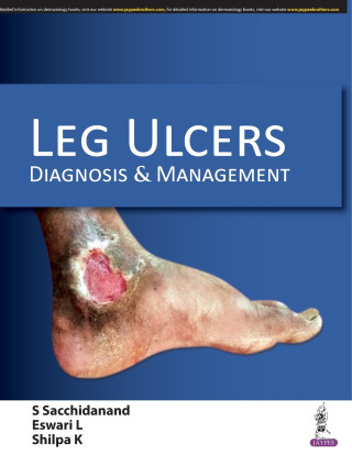 Leg Ulcers