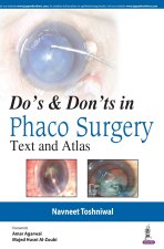 Do's & Dont's in Phaco Surgery