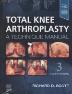 Total Knee Arthroplasty