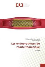Les endoproth?ses de l'aorte thoracique