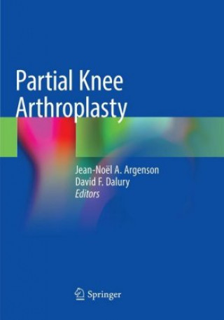 Partial Knee Arthroplasty