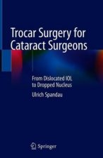 Trocar Surgery for Cataract Surgeons