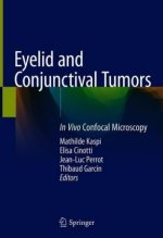 Eyelid and Conjunctival Tumors