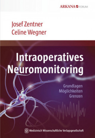Intraoperatives Neuromonitoring